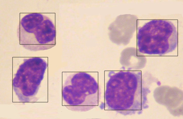 Fig.1. Detected cells